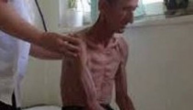 Naponta négyen halnak meg az országban TBC miatt