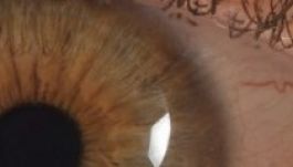 Ilyen az arcunk nagyon közelről (VIDEÓ)