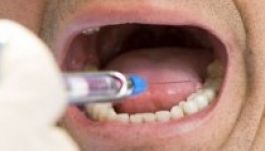 Ezek a fogászati szolgáltatások lesznek ingyenesek