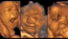 Az anyaméhben kezdik tanulni a mosolygást a babák