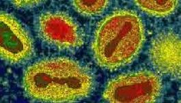 Megkegyelmeznek a gyilkos vírusnak?