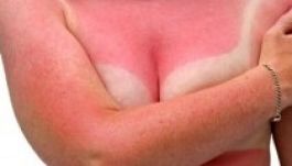 A bőrrák veszélyére kell figyelmeztetni a szoláriumoknál