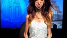 Életrajzi filmet forgat a világ legcsúnyább nője