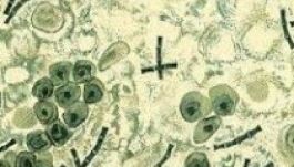 Nem fenyegeti Romániát a lépfenefertőzés