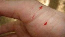 Hetente történik kígyómarás Háromszéken