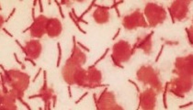 Felbukkant az anthrax Romániában, ember is fertőződhetett