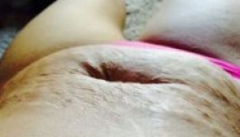 Megalázták a a terhességi csíkjai miatt, de nem hagyta szó nélkül