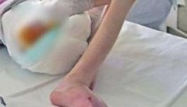 Éhen halt egy 67 éves Brassó megyei asszony