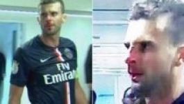 Egy életre eltiltanák a Thiago Mottát lefejelő csatárt (VIDEÓ)