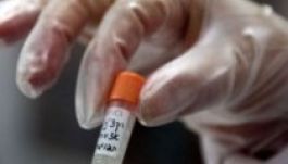 Meghalt egy kísérleti gyógyszerrel kezelt libériai beteg