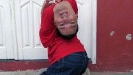 Motivációs szónok lett a hátrahajló fejjel született fiú