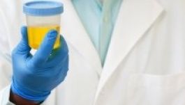 Méhnyakrák: vizeletvizsgálat válthatná a kenetvételt a szűréseken