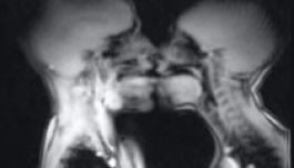 Ez történik az emberi testben szeretkezés közben (VIDEÓ)