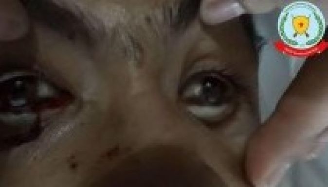 Megint vegyi fegyvert vethettek be Szíriában