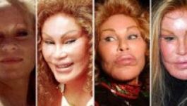 Sokan járnak pórul a kozmetikai műtétekkel