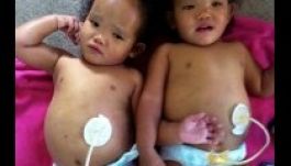 Csak egyik haldokló gyermekét mentheti meg az apa