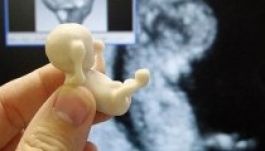 Abortuszturizmust hirdet egy magyarországi honlap