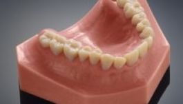 Új fogsort is lehet már nyomtatni