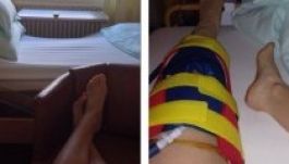 Megműtötték Miklós Edit sérült térdét