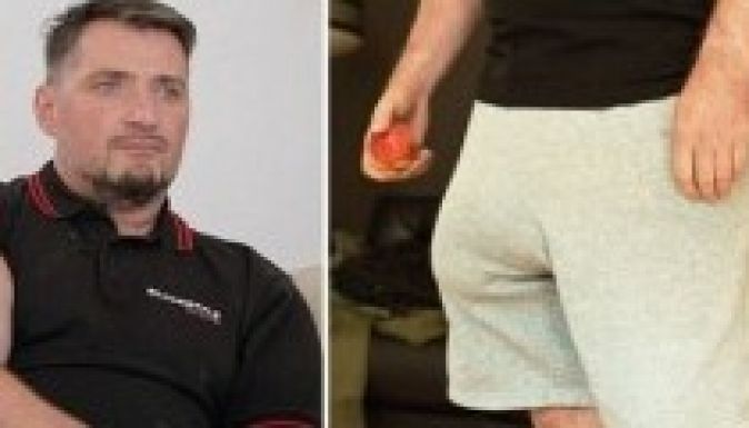 Óriásira nagyobbíttatta a péniszét egy német férfi