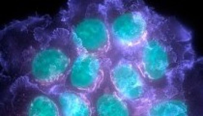 A mell rákos daganata