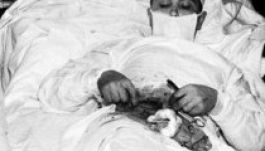 Az ember, aki kioperálta a saját vakbelét