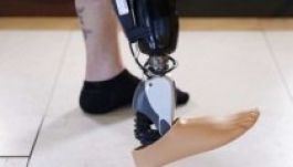 Gondolattal vezérelt kibernetikus láb készült