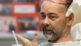 Új fejbőrt és koponyacsontot kapott egy szoftverfejlesztő (VIDEÓ)