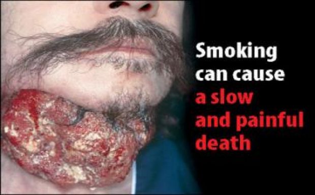 Szlovákiában is elrettentő képek kerülnek a cigarettás dobozokra