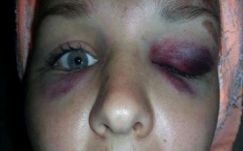 Megvertek egy lányt Szegeden, mert bevándorlónak nézték a barátját