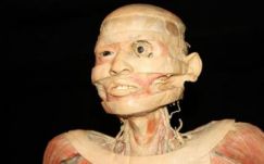 Petícióval tiltakoznak a kiállított holttestek ellen Kolozsváron