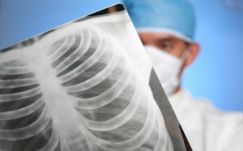 Légiós betegség ölt meg hét embert New Yorkban