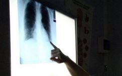 Lenyelve próbálták kicsempészni a drágakövet