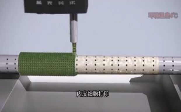 Személyre szabott szerveket is nyomtathatunk hamarosan