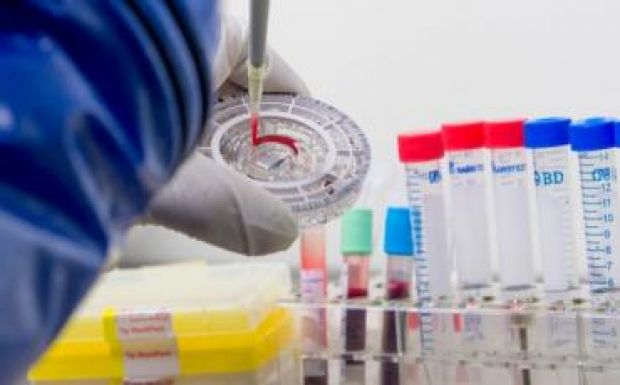 Két ebola-vakcinát állítottak elő az oroszok