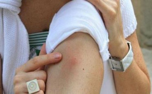A WHO meghatározta a zikavírus feletti győzelem dollárban mért árát