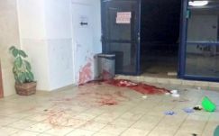 Életveszélyesen megsebesítettek egy éjjeli őrt egy ciszjordániai zsidó telepes városban