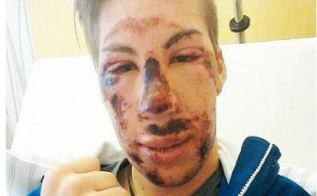 Felismerhetetlenségig összetörte magát a Négysáncverseny 2014-es bajnoka