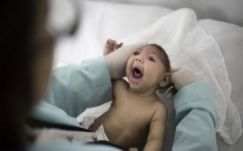 Megszületett az első kóros kisfejűségben szenvedő európai csecsemő