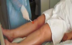 Sebestyén Mihály: A noszokómia lépcsei