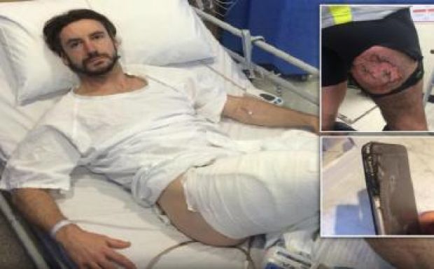 Csúnyán megégette tulajdonosa combját egy iPhone