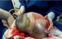 Burokban jött a világra 