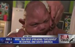 Sokkal veszélyesebb lehet a zikavírus, mint eddig hitték