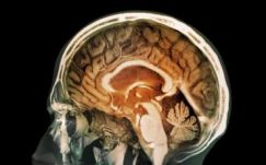 Légszennyező részecskéket fedeztek fel az agyban