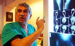 Marhacsontot ültetett be pácienseinek egy bukaresti orvos