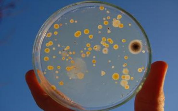  „Hargitai” a Romániából elsőként leírt új baktériumnemzetség