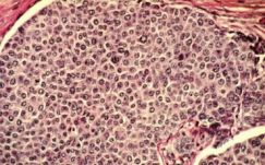 Fontos lépést tettek a magyar kutatók a daganatos betegségek megértése felé