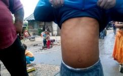 FRISSÍTVE - Kanyaróhelyzet Csíksomlyón: a hatóságok szerint nincs ok pánikra