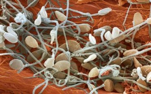 Egyre kisebb a nyugati férfiak spermiumszáma