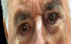 Bíró Béla: Mercron kockázatai